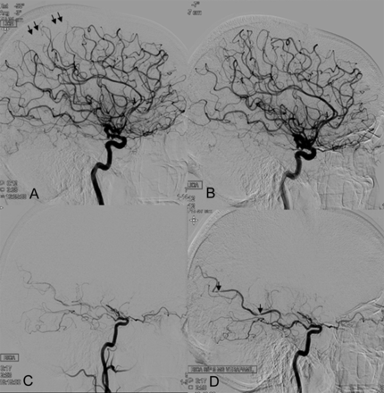 FIG 1.