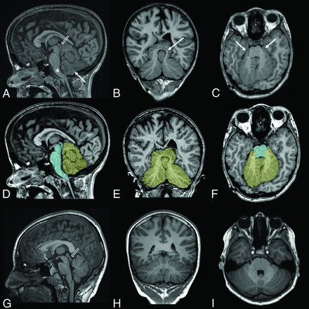 FIG 1.