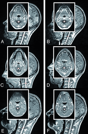 FIG 4.