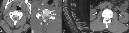 FIG 1.