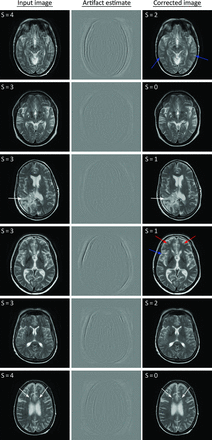 Fig 5.