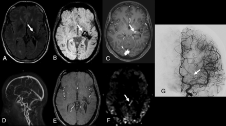 Fig 2.