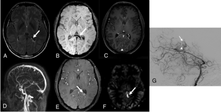 Fig 5.