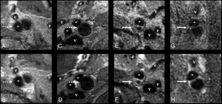 Fig 2.