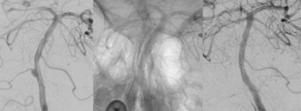 Fig 2.