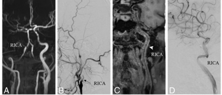 Fig 3.