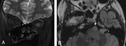 Fig 4.