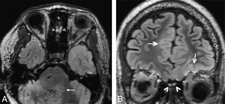 Fig 5.