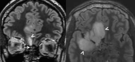 Fig 8.