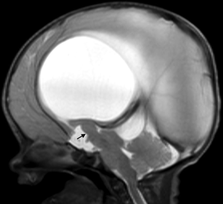 Fig 5.