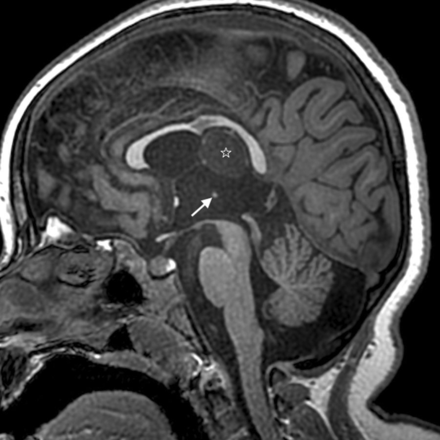 Fig 6.