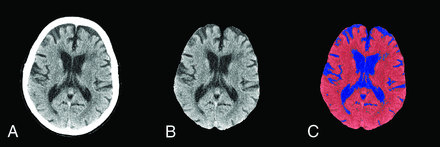 Fig 1.
