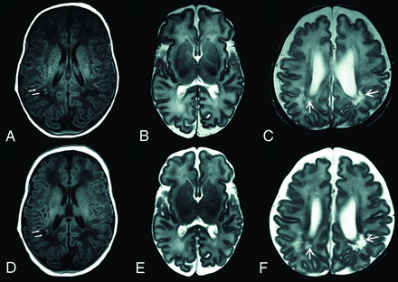 Fig 2.