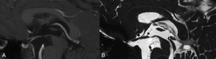 Fig 1.