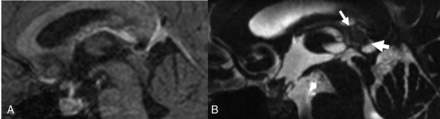 Fig 2.