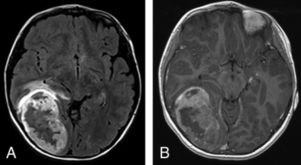 Fig 1.