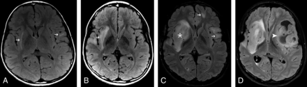 Fig 3.