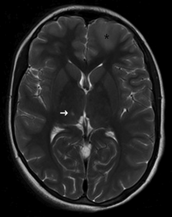 Fig 6.