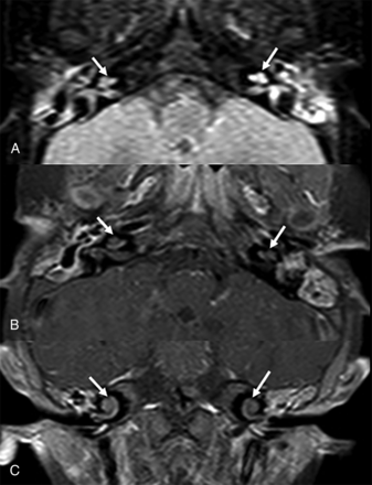Fig 3.