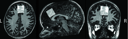 Fig 1.