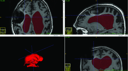FIG 4.