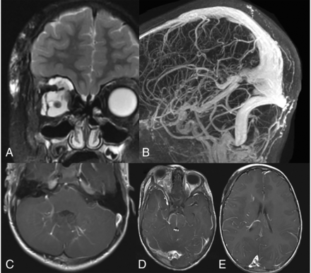FIG 3.