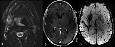FIG 4.