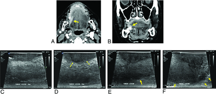 FIG 3.