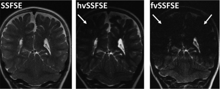 FIG 3.