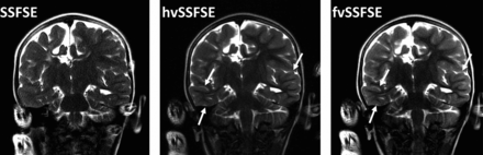 FIG 4.