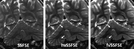 FIG 5.