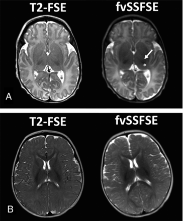 FIG 6.