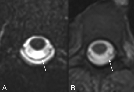 FIG 1.