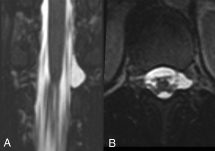 FIG 2.