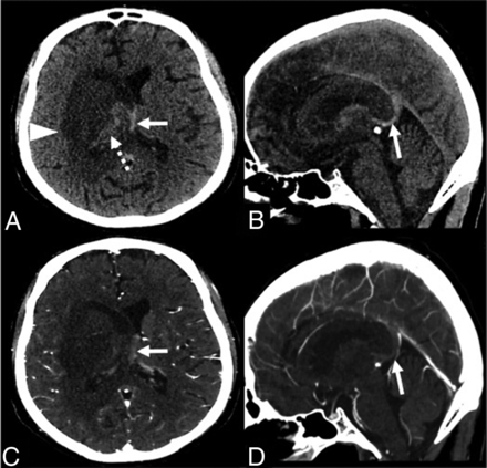 Fig 1.