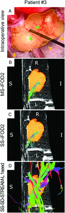 Fig 2.