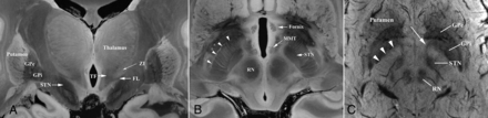 FIG 2.