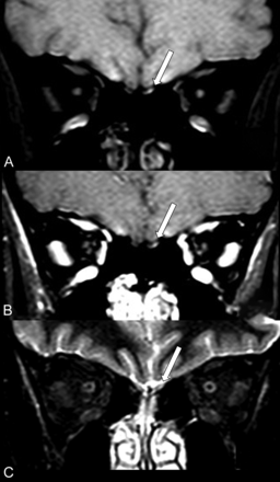 FIG 1.
