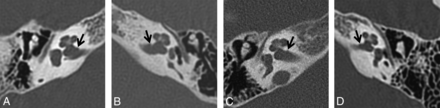FIG 2.