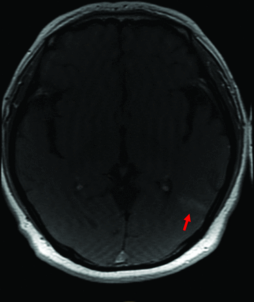 FIG 4.