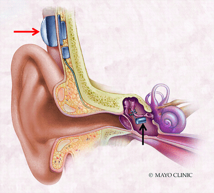 FIG 10.