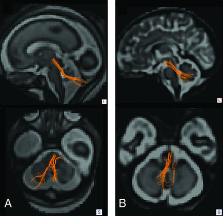 FIG 1.