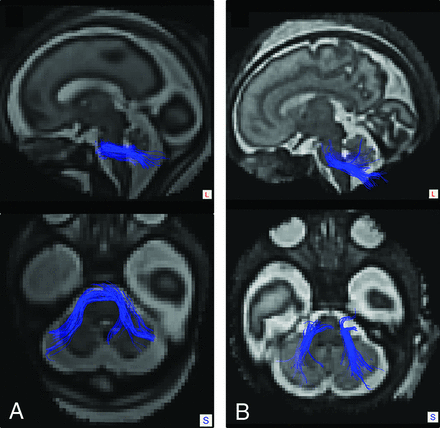 FIG 2.