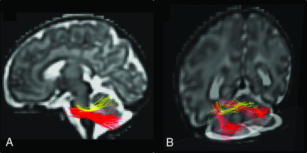 FIG 3.
