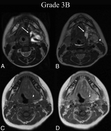 FIG 3.