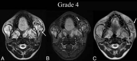 FIG 4.