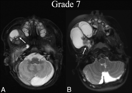 FIG 7.