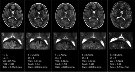 FIG 3.