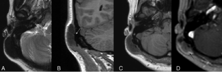 FIG 3.