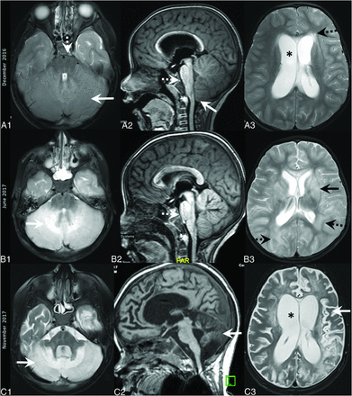 FIG 2.